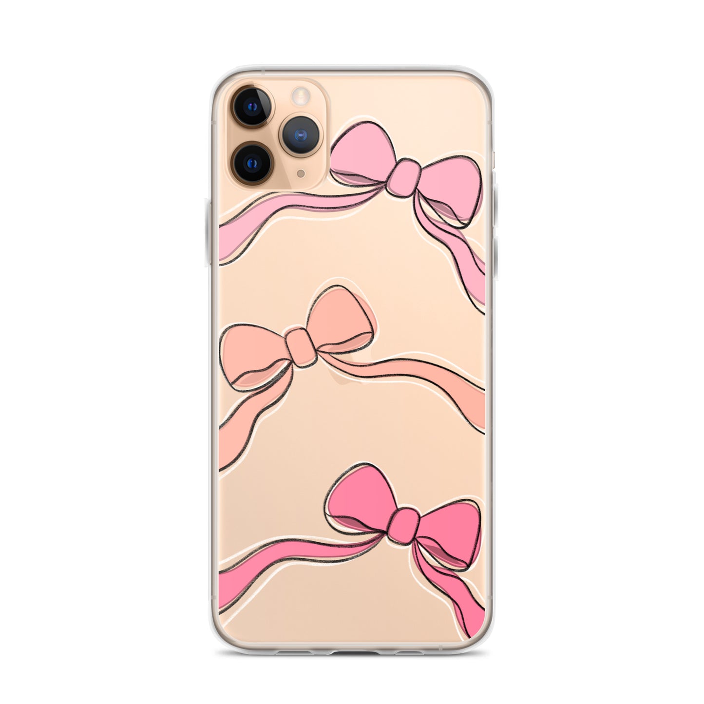 Valentines day bow phone case