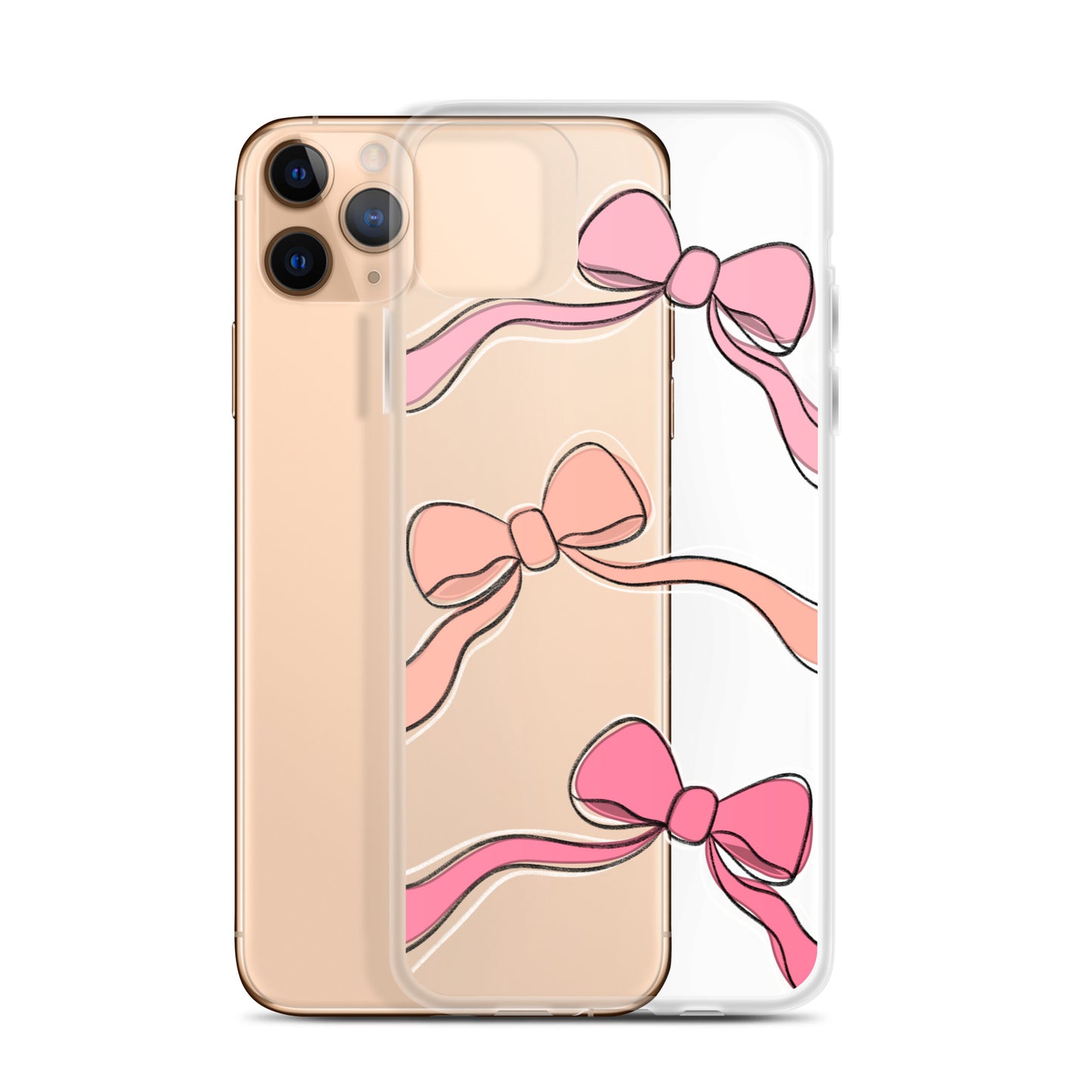 Valentines day bow phone case