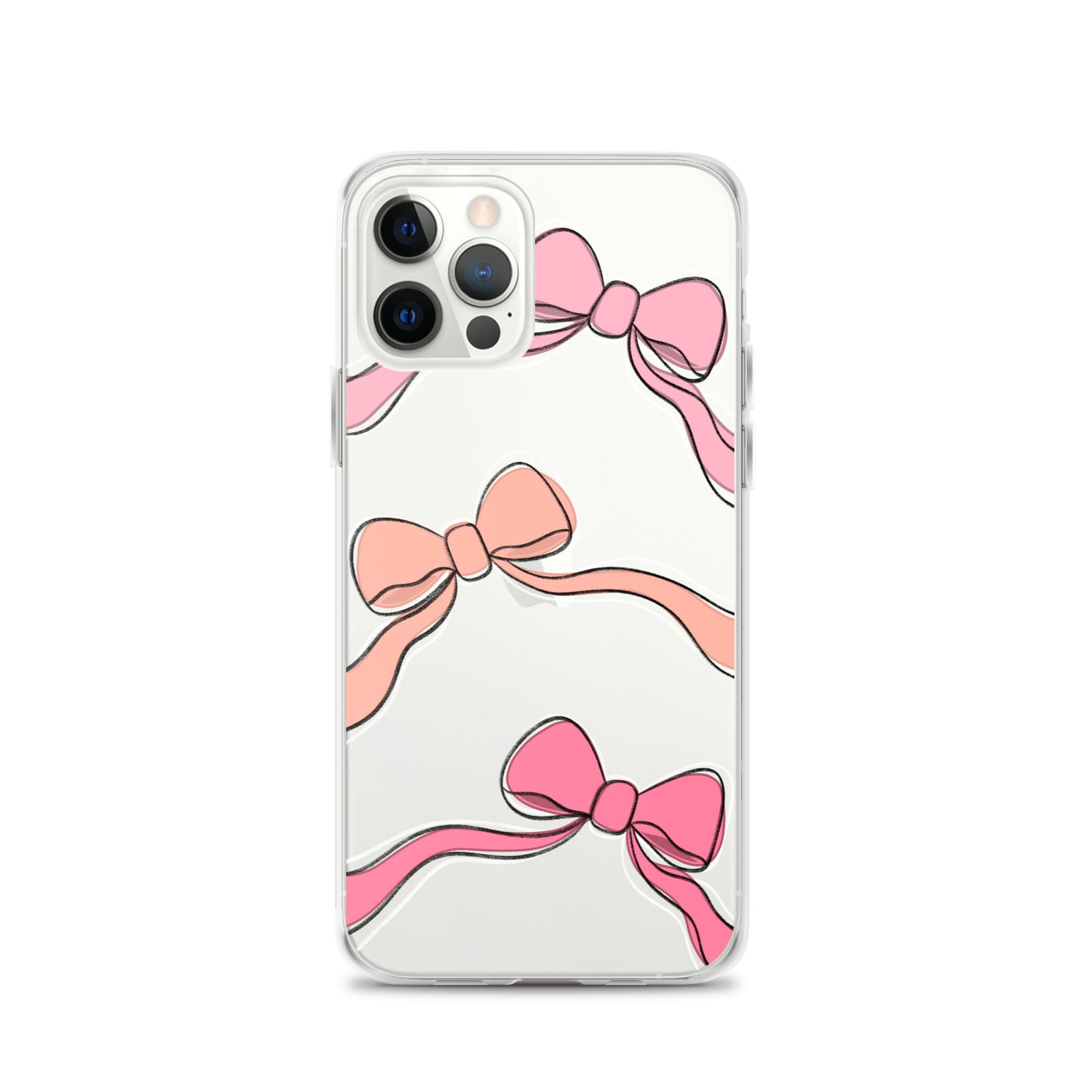 Valentines day bow phone case