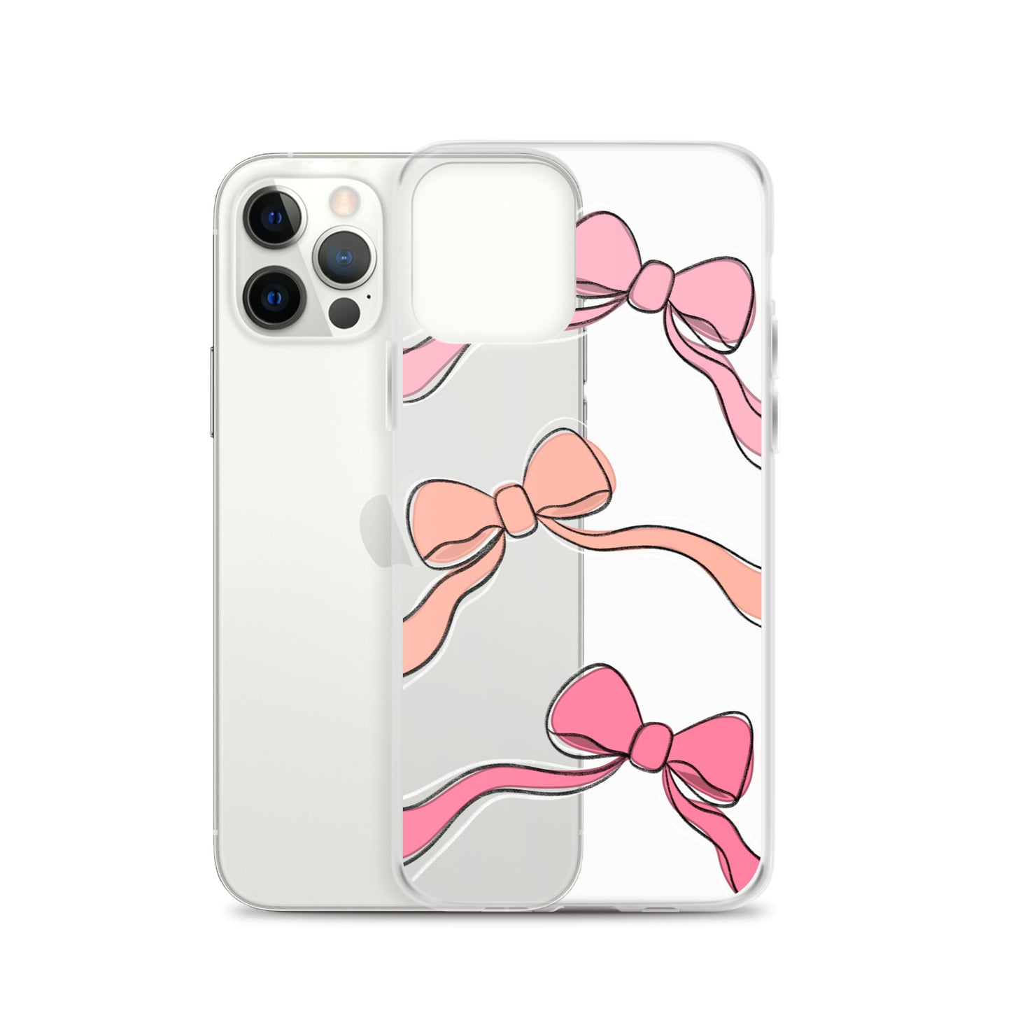 Valentines day bow phone case