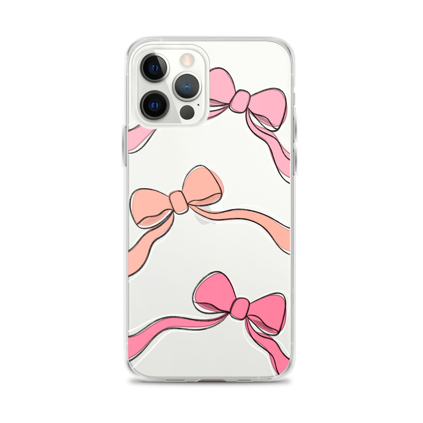 Valentines day bow phone case