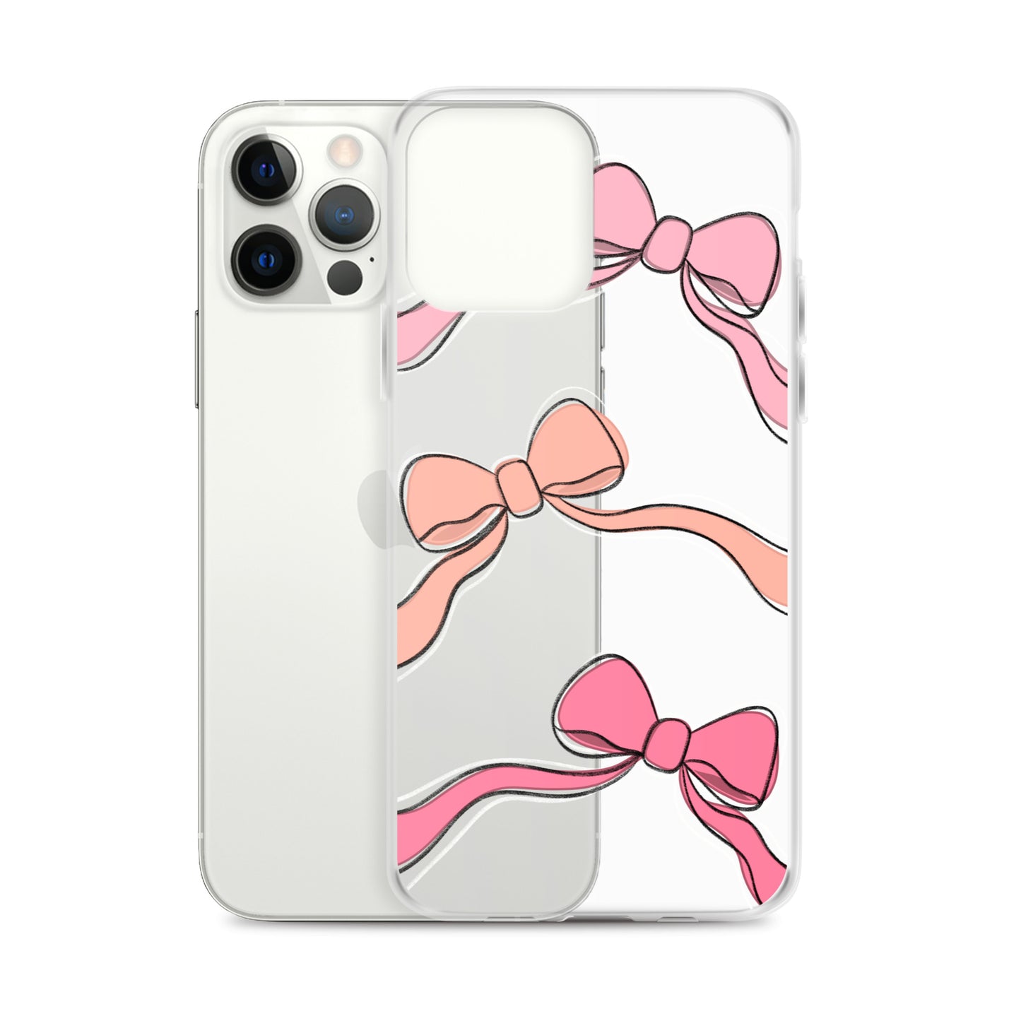 Valentines day bow phone case